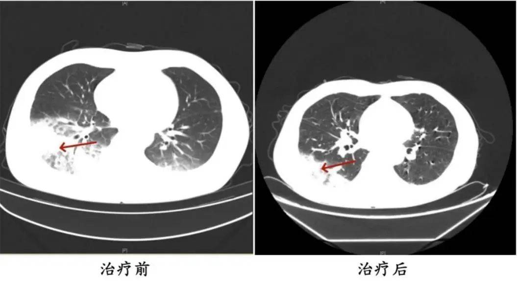 025高考考生最关心的这些问题有解答→人生就是博-尊龙凯时【早安·盱眙】2(图2)